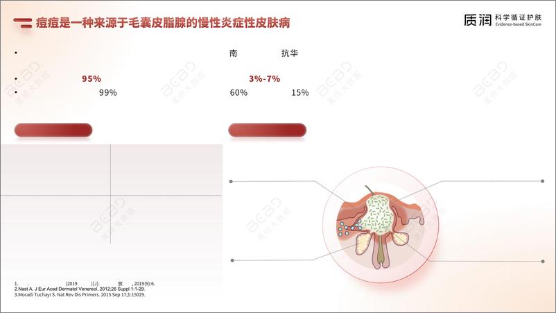 《壬二酸科学祛痘消费者报告》 - 第4页预览图