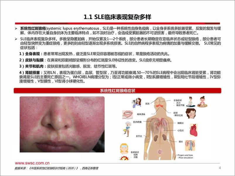 《西南证券-医药生物：系统性红斑狼疮蓝海市场，生物制剂脱颖而出》 - 第5页预览图