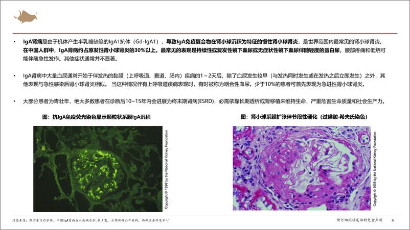 《IgA肾病行业报告：多项靶点临床试验进展积极，IgA肾病新药步入收获期-241223-西部证券-53页》 - 第4页预览图