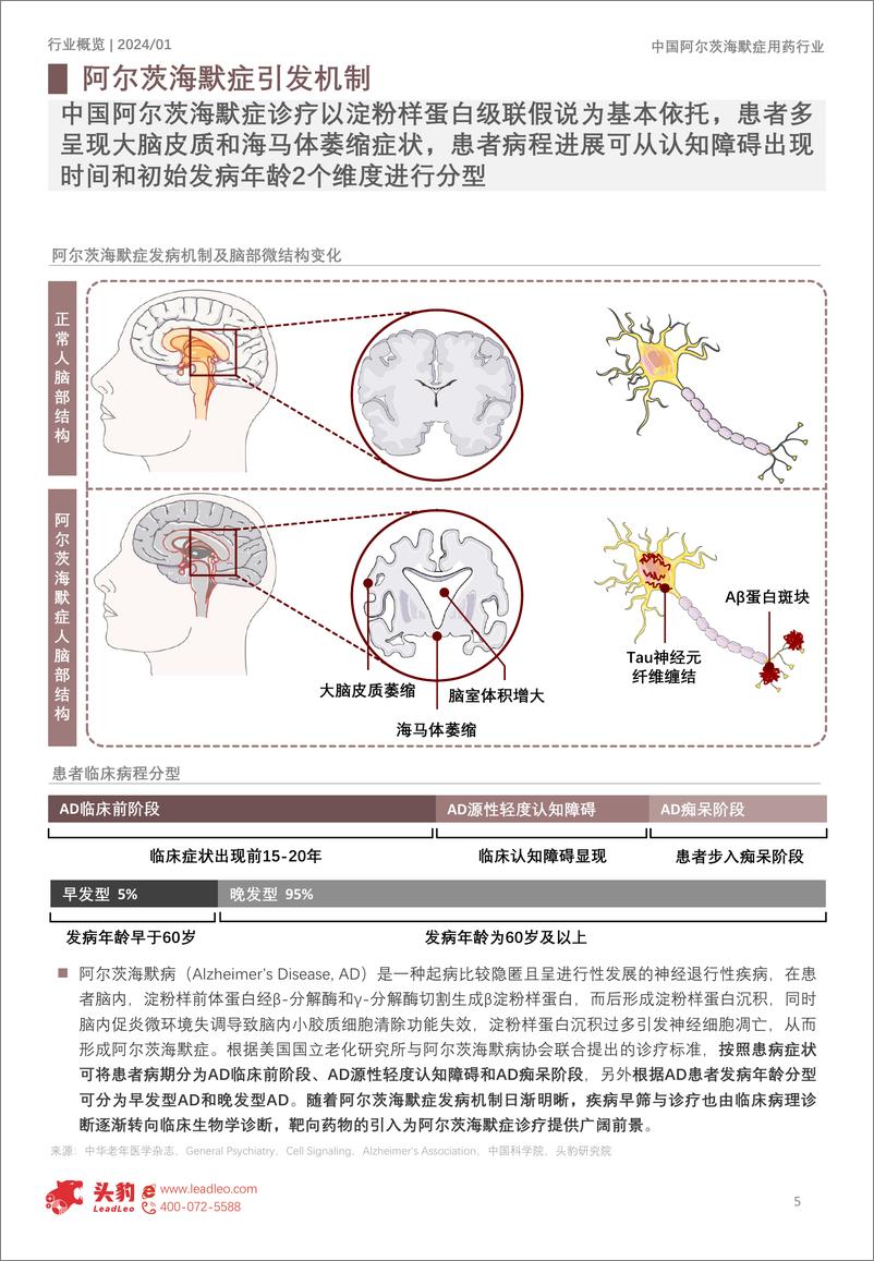 《头豹研究院-2024年中国阿尔茨海默症用药行业概览：本土仿制药崛起，阿尔茨海默症用药市场迎来新机遇》 - 第5页预览图