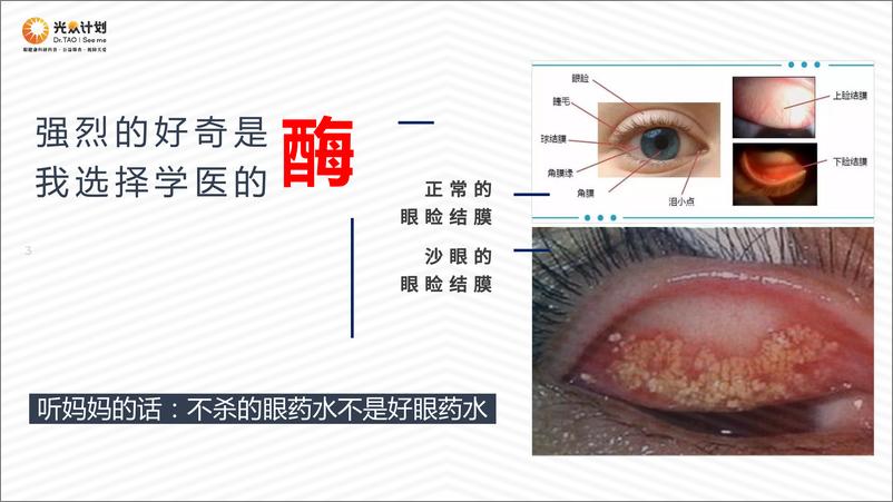 《北京朝阳医院（陶勇）：酶、抗体与光感受器-一名眼科医生的教育视角》 - 第3页预览图