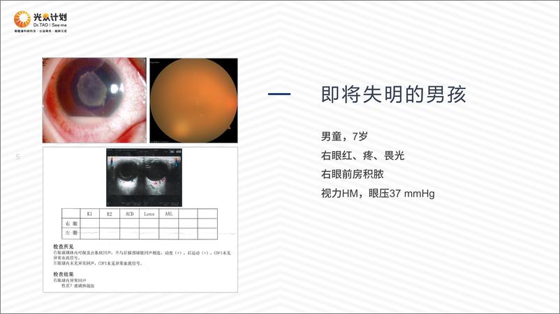 《北京朝阳医院（陶勇）：酶、抗体与光感受器-一名眼科医生的教育视角》 - 第5页预览图