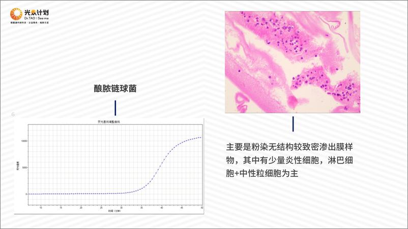 《北京朝阳医院（陶勇）：酶、抗体与光感受器-一名眼科医生的教育视角》 - 第6页预览图