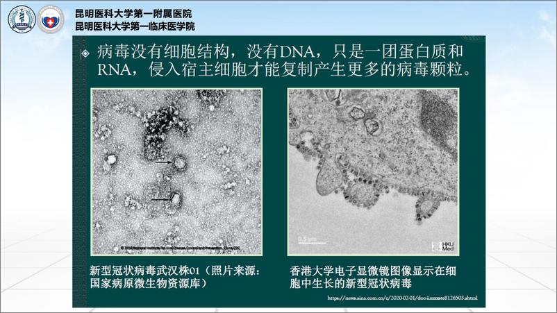 《昆明医科大学-新冠肺炎影像学诊断要点-2020.2.13-32页》 - 第4页预览图