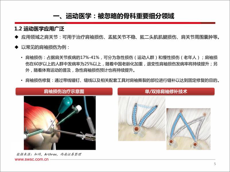 《医药行业之骨科运动医学专题报告：行业方兴未艾，国产替代开启-20200312-西南证券-24页》 - 第7页预览图